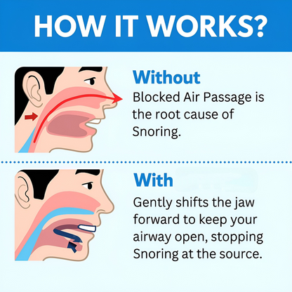 Hushly® Anti Snoring Mouthpiece